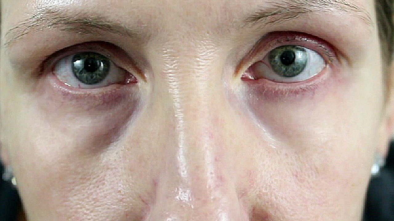 HOW TO GET RID OF BAGS UNDER EYES MAKEUP FOR MATURE SKIN