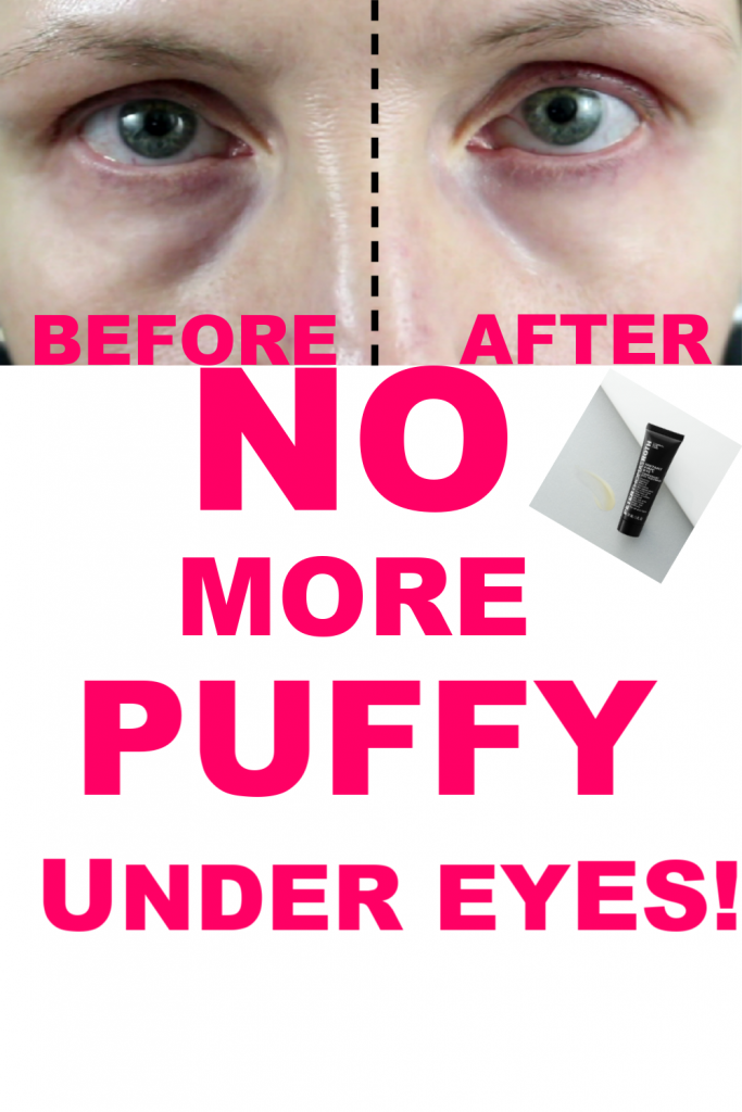 GET RID OF PUFFY UNDER EYES