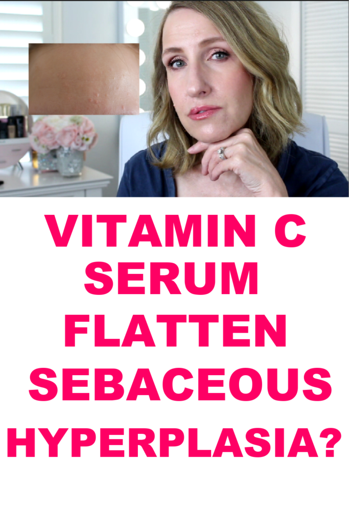 SEBACEOUS HYPERPLASIA TREATMENT?