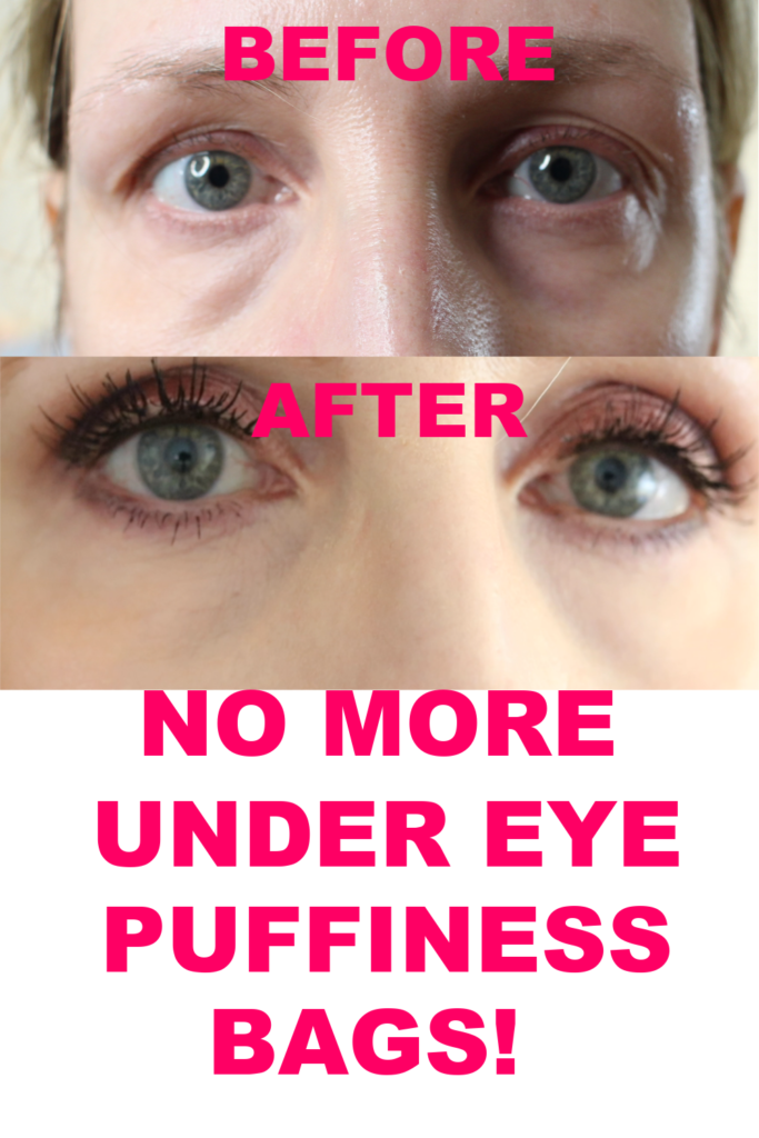 HOW TO GET RID OF UNDER EYE PUFFINESS AND BAGS!