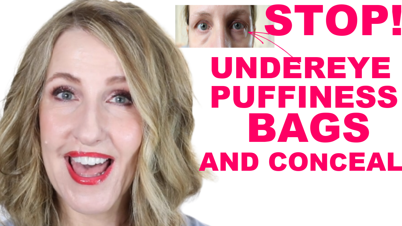 HOW TO GET RID OF UNDER EYE PUFFINESS AND BAGS! ANNE P