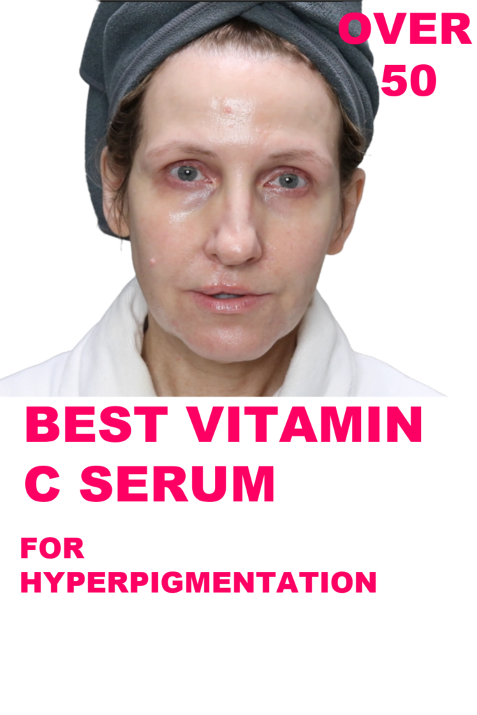 BEST VITAMIN C FOR HYPERPIGMENTATION