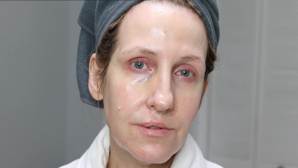 BEST VITAMIN C SERUM FOR HYPERPIGMENTATION ANNE P MAKEUP AND MORE